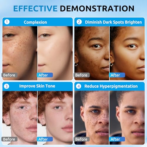 Dark Spot Corrector Serum for Face & Body - Brightening Hyperpigmentation Treatment, 2 Fl Oz