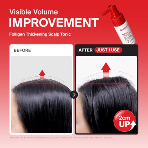 Scalp Care Kit for Hair Thinning & Loss - Travel Size 4-Step System