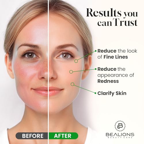 Castor Oil Roll On for Face: Castor Oil with Rose Quartz Roller for Massage - Deep Hydration Skin Moisturizer - Birthday Valentine Gifts for Women 35-65 (1.7 FL. OZ.)