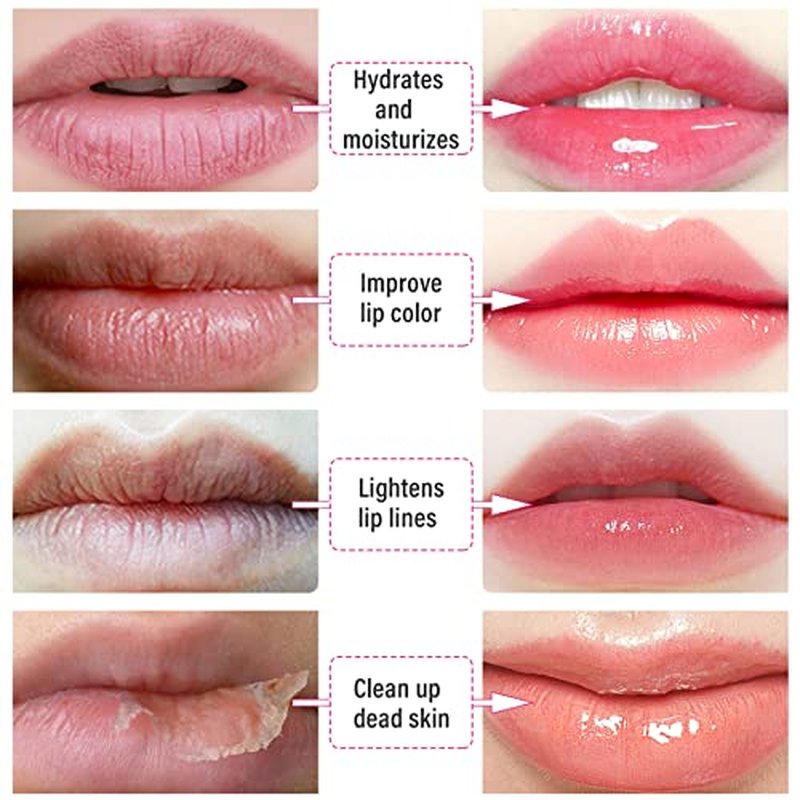 30 PCS Moisturizing Hydrating lip masks - Pink Collagen Lip mask Bulk,Collagen Lip Gel Patches for Dry Lips, Dead Skin Removal, Fine Line Lightening, Valentine's Day Gift