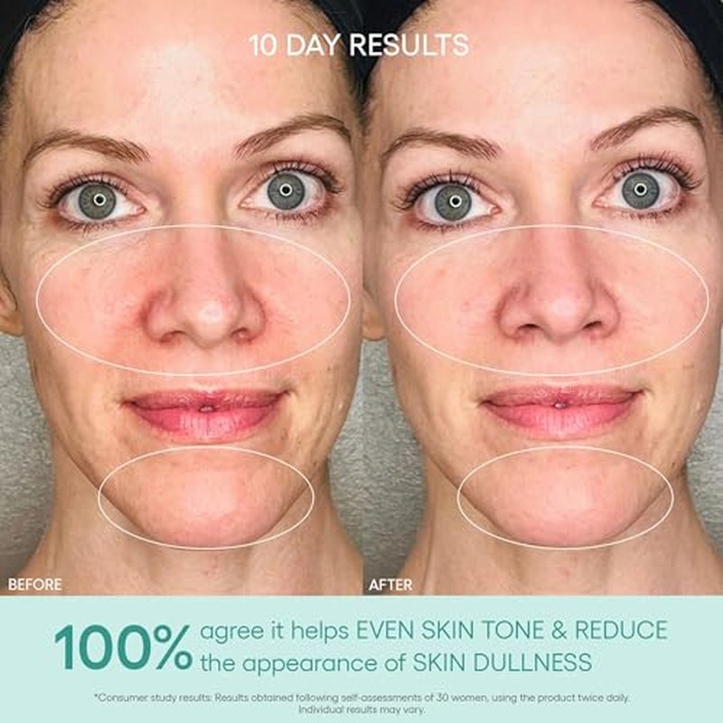 Algenist GENIUS Liquid Collagen Essence - Liquid Collagen Serum with Patented Alguronic Acid to Help Improve Skin Bounce, Elasticity & Radiance (3.4 oz)