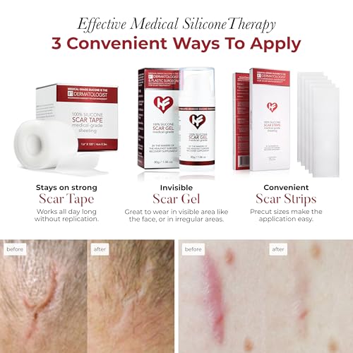 HealFast Scar Care Bundle - Silicone Gel, Sheets & Tape for Surgery - Variation of THIS listing