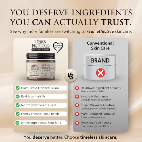 Urban Naturals Handmade Whipped Tallow Balm (Vanilla) - 100% Grass-fed Organic Body Butter with Infused Jojoba Oil, for Eczema, Rosacea, Baby - 2 oz