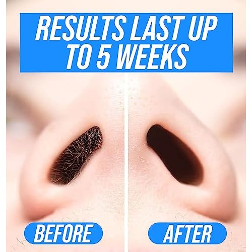 Kenashii Super BUNDLE Nose & Ear Hair Removal Kit | 100 g Wax, 84 Applicators | No Microwave Needed | Nasal Waxing For Men and Women | 12 Balm Wipes, Mustache Guards, Storage Bag