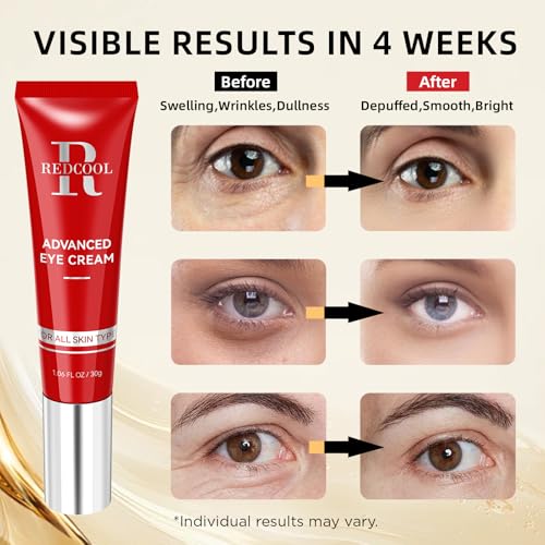 Retinol Eye Cream for Dark Circles, Anti-Aging Eye Cream with Hyaluronic Acid & Caffeine, Reduces Wrinkles, Puffiness & Fine Lines, Day and Night Use, 1.06 fl oz
