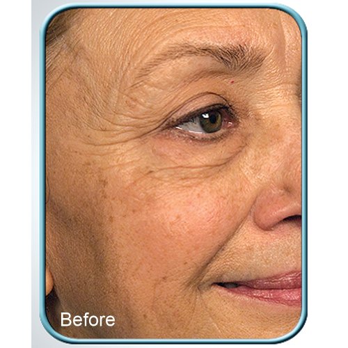Stem Cell Therapy Cream - Anti-Aging Skin Rejuvenation 1oz Pack of 1