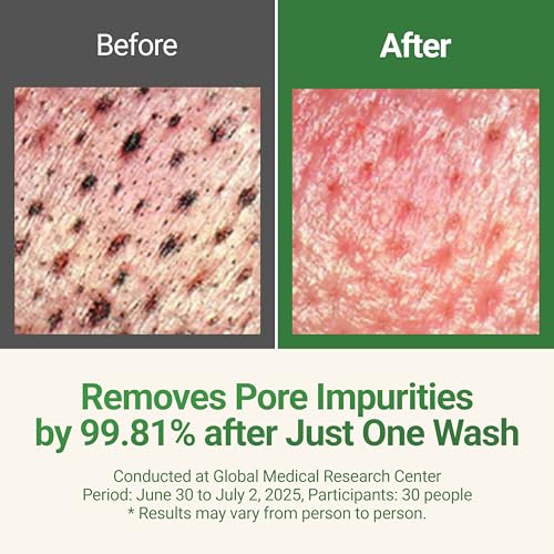 Superfood Hydrating Natural Cleansing Oil, Vegan, 200mL, 6.76 fl oz, Gentle Makeup Remover for Sensitive Skin, Korean Oil Cleanser