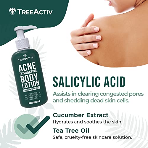 Acne Body Lotion for Clear Skin - Moisturizer with Tea Tree & Cucumber - 8 fl oz
