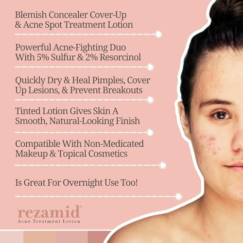 Acne Spot Treatment Lotion with Sulfur & Resorcinol for Oily Skin - 2oz