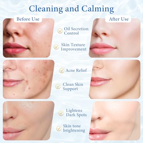 Exfoliating Toner Pads for Face & Body with Salicylic Acid, Cica & Hyaluronic Acid, 70 Count
