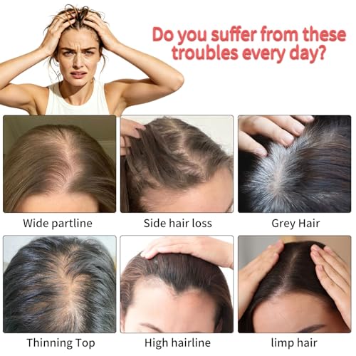 Blonde Human Hair Hair Topper 10 Inch Swiss Base for Thin Hair Natural Look - Variation 1213-613# Lightest Blonde
