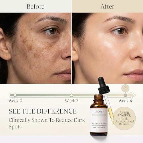 Vitamin C Radiance Serum | Vitamin E + Ferulic Acid | Brightens, Hydrates & Protects Skin | Vegan & Cruelty-Free | 1oz