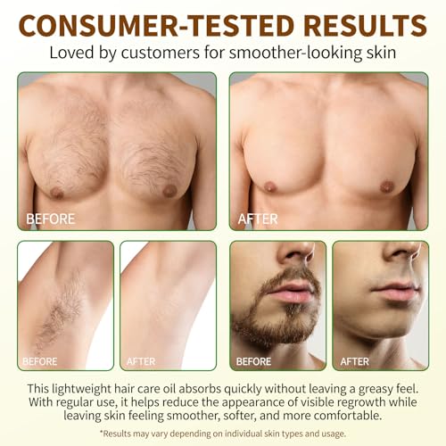 Cyperus Rotundus Hair Removal Oil - 3 Pack, Natural Skin Soothing & Hair Growth Inhibitor, 2.02 Fl Oz Each