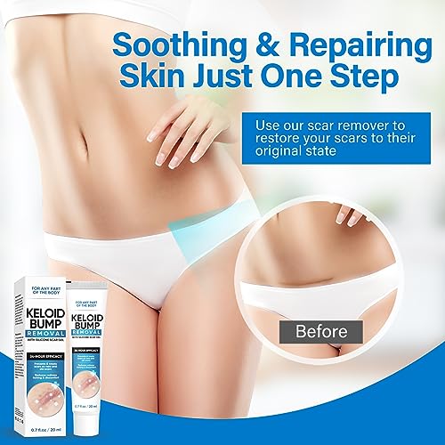 Keloid Bump Cream, Silicone-Based Scar Cream for Face & Body, Advanced Formula to Improve Appearance of Keloids & Raised Scars, 0.7 Fl Oz