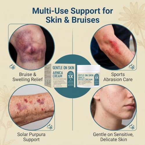 Arnica Bruise Cream with Vitamins K, C & E - Supports Skin Healing, 4.23 oz