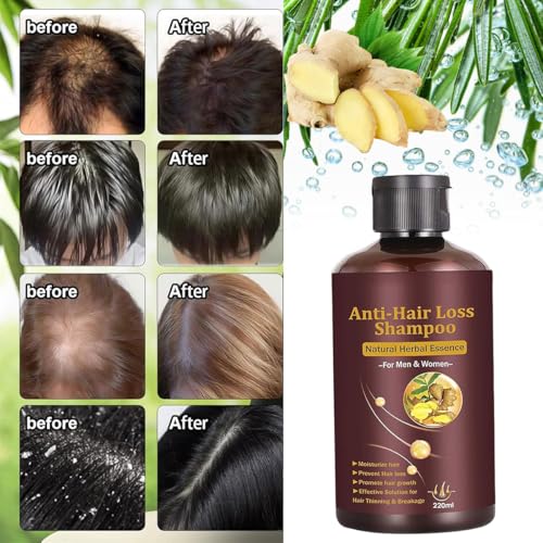 Anti-Thinning Hair Growth Shampoo for Men & Women 220ML - Strengthening & Nourishing