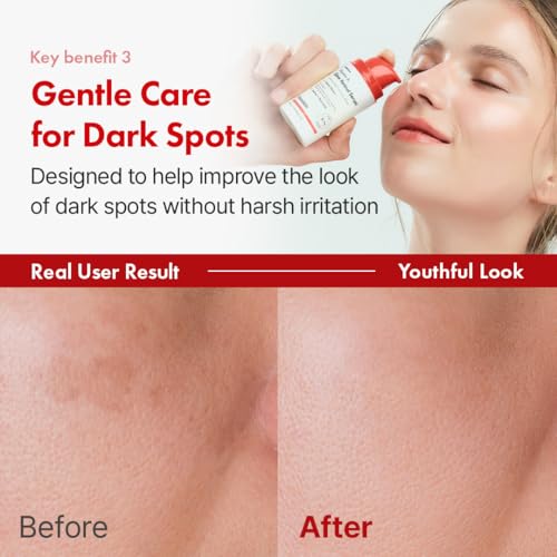 Hanskin 0.1% Pure Retinol Facial Serum for Face, Reduce Fine Lines & Wrinkles, Signs of Aging for Day & Night, Smoothing Firming Revitalizing, Animal Testing Free, Korean Skincare, 30ml/1.01 FL Oz