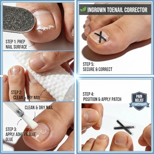Bememo 24 Pcs Large Small Stainless Nail Clippers Set Fingernail and Toenail Clippers Bulk with File Pedicure Flat Portable Travel Manicure Care Tool Cutter for Women Men Homeless (Silver and Black)