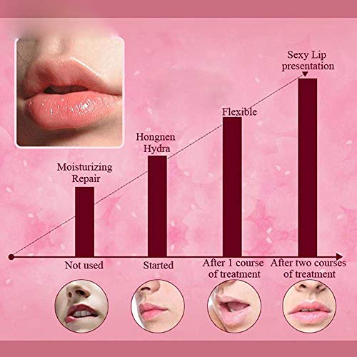 Microdart Acne Patch (18 Patches) - Hyaluronate Acid & Salicylic Acid Hydrocolloid Pimple Patch for Deep, Early and Hidden Blemishes (18 Count (Pack of 1))