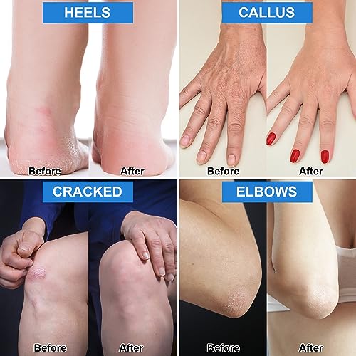 White Urea Foot Cream 2 Pack - Deep Moisturizer for Cracked Heel & Skin Repair