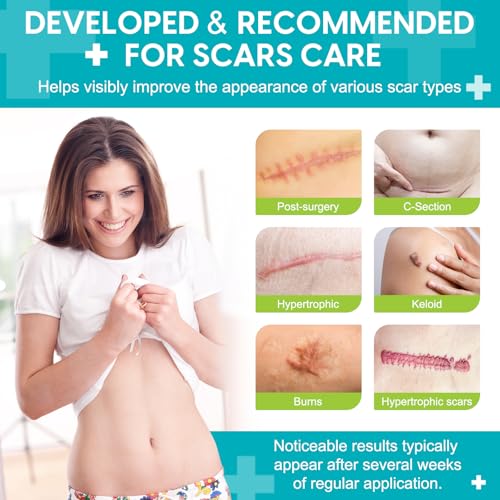 Silicone Scar Sheets (1.6¡± x 120¡±), Medical Grade Scar Tape for C-Section, Surgery, Keloid, Burn, Acne Scars - Reusable, Pain-Free, Safe for Sensitive Skin