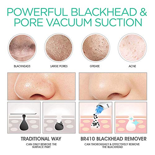 VOYOR Blackhead Remover Pore Vacuum - Facial Cleansing Brush Rechargeable Face Spin Brush for Deep Cleansing