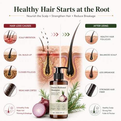 Onion Hair Growth Shampoo with Rosemary & Biotin - Thickening & Strengthening Formula for All Hair Types - 10 fl oz