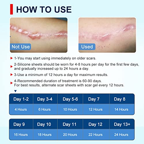 Silicone Scar Sheets Tape for Surgical Scars, C Section Scar Silicone Strips, Medical Grade, Reusable, Soften and Flattens Scars, Breast, Keloid, Professional Scar Patches. (1.8x157 Inch)