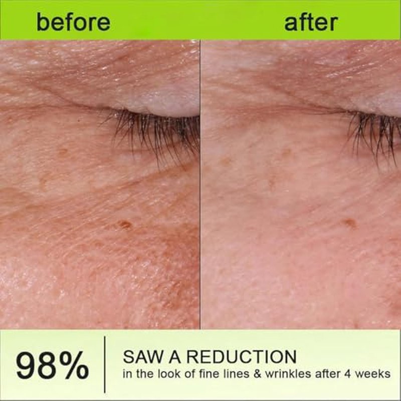 2 Pack Botoxmix & Vita-A Retinol Shot Wrinkle-Lift Tightening Cream, Anti Wrinkle, Pore Minimizer, Fine Lines, All Skin