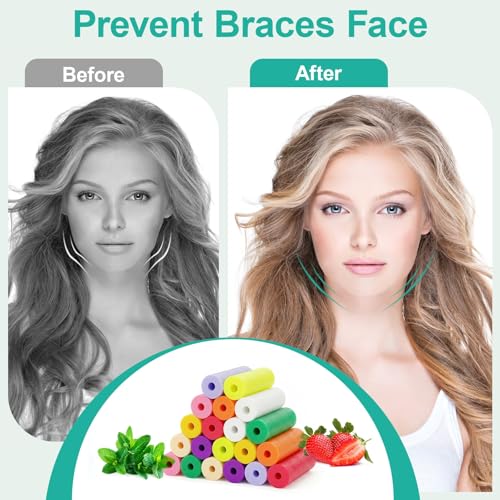 200 Pack Soft Silicone Aligner Chews for Invisalign - Mix Colors