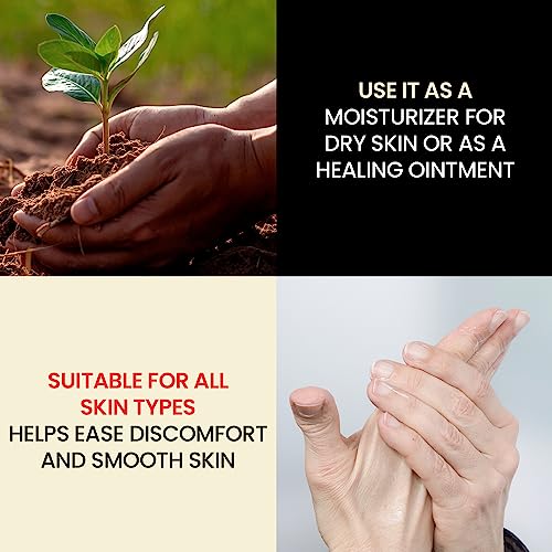 Dr. Hess' 1893 Original Udder Ointment, All-Purpose Nourishing Body Moisturizer for Healing Dry, Irritated Skin, Cracked Heels, Rashes, Chafing with Lanolin, Beeswax, & Eucalyptus Oil, 1.4 oz