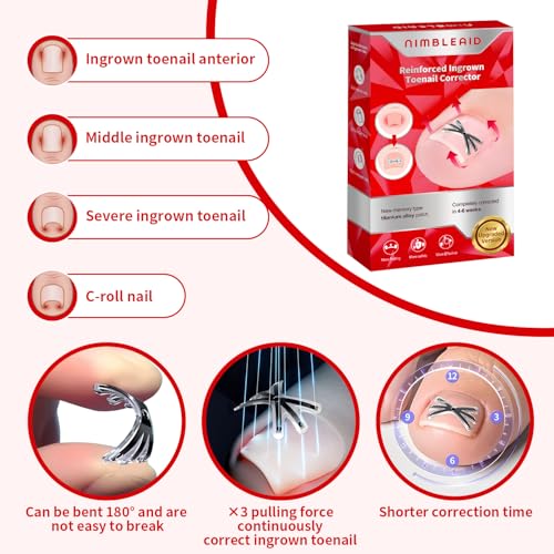 Upgraded Titanium Alloy Ingrown Toenail Corrector with Upgraded 6-Angle Shape,3x Stronger Pull Force,Ingrown Toenail Removal Kit, Ingrown Toenail Treatment for Women and Man (S size - 6 Packs)