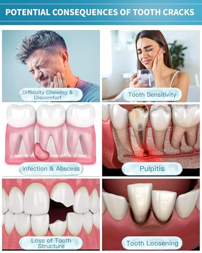 Healing Teeth Crack Toothpaste - Repair & Remineralize Enamel, 3.52oz Pack of 1 - Cracked Teeth Care