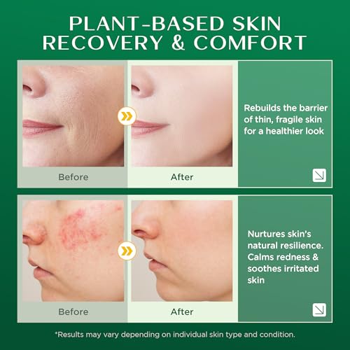 Vigority Arnica Bruise Cream 3.4oz with Helichrysum - Unscented, for Sensitive Skin, 1 Pack