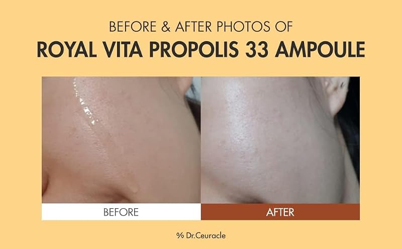 Hydrating Vitamin Serum with Royal Jelly & Propolis - Face Brightening & Anti-Aging