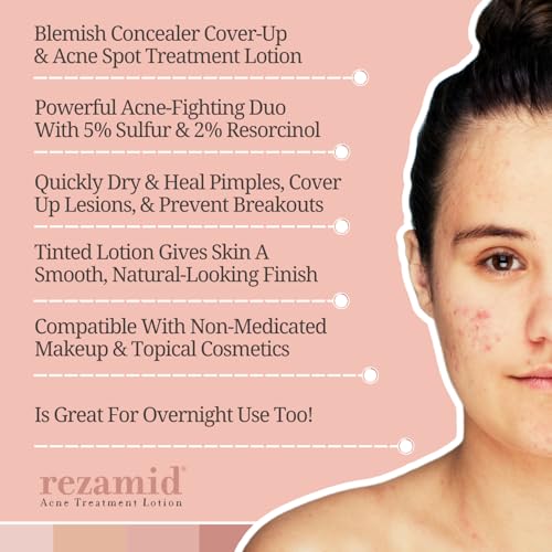 Acne Spot Treatment Lotion with Sulfur & Resorcinol, Skin Tone Matching Concealer, 2oz