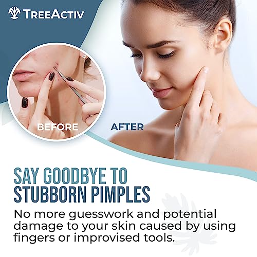 TreeActiv Pimple Popper Tool Kit with Face Wash and Acne Patches, Professional Blackhead Milia Remover Tools Facial Kit, Stainless Steel Blackhead Extractor Tool, Blemish Blackhead & Whitehead Pimple