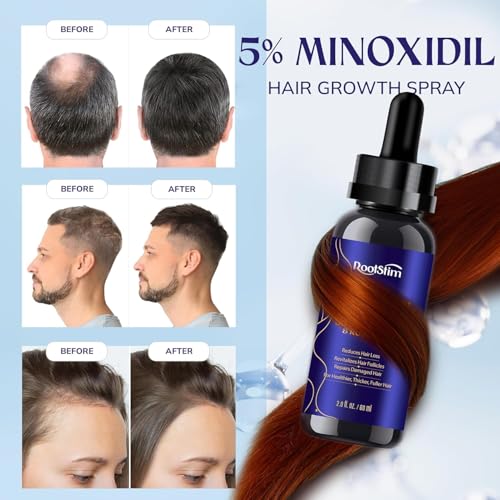 2 Pack Minoxidil Hair Growth Serum for Men & Women - 5% with Biotin & Rosemary, 2.02 Fl Oz