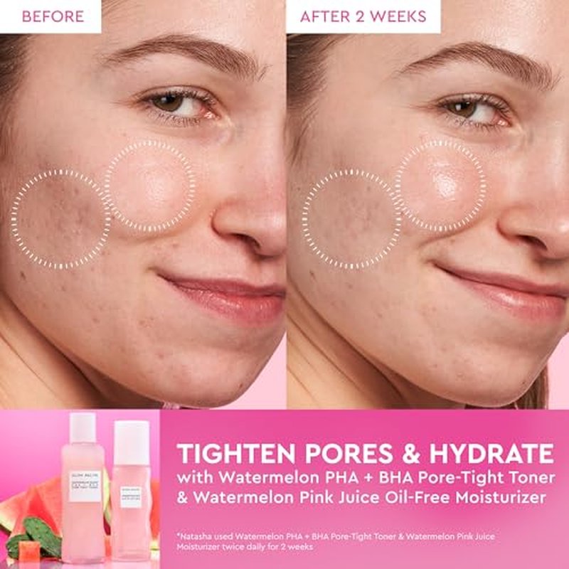 Glow Recipe PHA + BHA Face Toner - Korean Skin Care Pore Minimizer & Gentle Facial Exfoliator for Tightening, Hydrating & Exfoliating - Glycerin, Watermelon & Cactus Water (150ml)