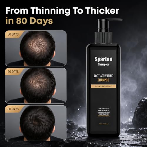 Herbal Hair Growth Shampoo for Men and Women - 500ML Root Activator for Thinning Hair & Hair Loss
