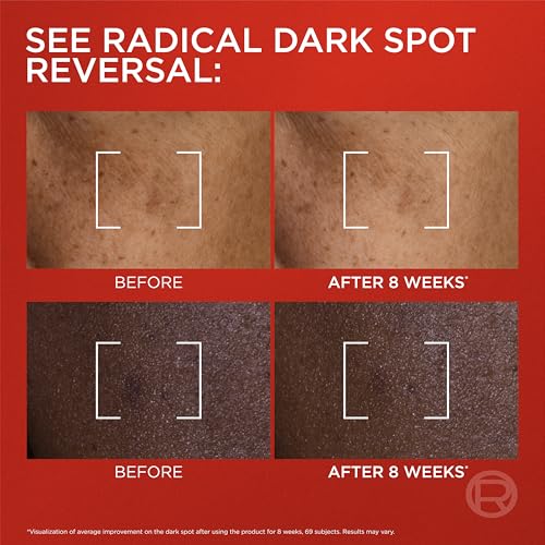 Dark Spot Corrector Serum for Face & Neck - Brightening & Anti-Aging, 1.7 fl oz