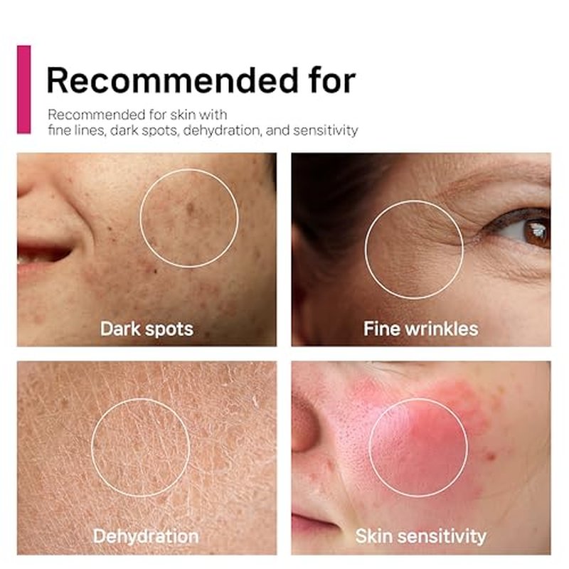 Arbutin 7% + Tranexamic Acid 5% + Niacinamide 2% Intensive Tone Care Facial Cream -Dark Spots, Freckle, Blemishes, Pigmentation, Dull & Uneven-Looking Tone w/ Alpha Arbuitn 20,000 ppm Korean Skincare
