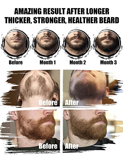 Men's Beard Grooming Kit with Sandalwood Oil - Conditioner, Oil & Care Set