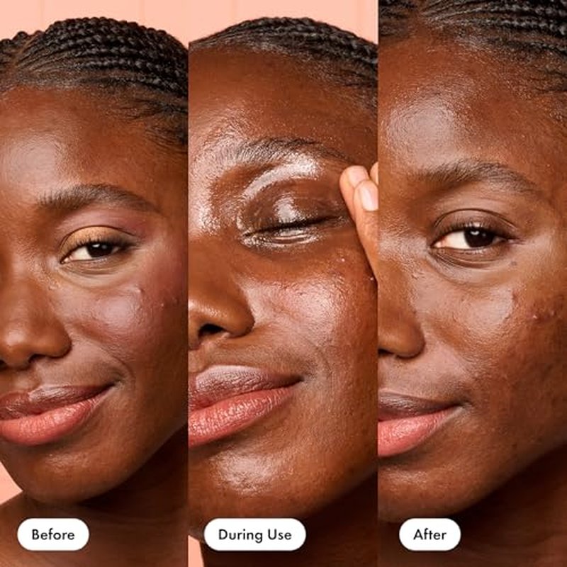 HERO COSMETICS Dissolve Away Daily Cleansing Balm, Helps Remove Makeup and Grime, Won¡¯t Clog Pores, Suitable for Sensitive and Acne-Prone Skin (2.2 fl oz)