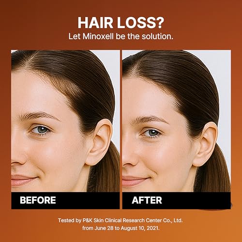 Korean Hair Growth Shampoo for Thinning Hair - 13.52 fl oz