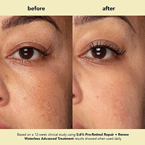boscia 0.6% Pro-Retinol Repair + Renew Waterless Advanced Treatment - Vegan, Cruelty-Free, Natural Skin Care - For Fine Lines & Wrinkles - 1 fl oz