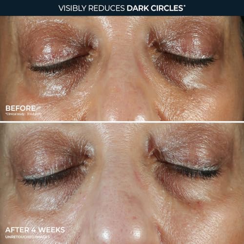 Brightening 5-in-1 Eye Cream for Dark Circles Wrinkles Puffiness - 0.5oz