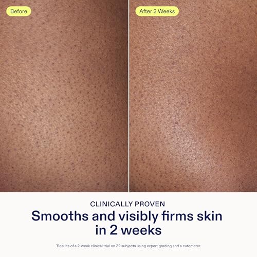 Skinfix AHA/BHA Renewing Body Cream 10 oz – Vegan, Cruelty Free | 10 Ounce (Pack of 1)
