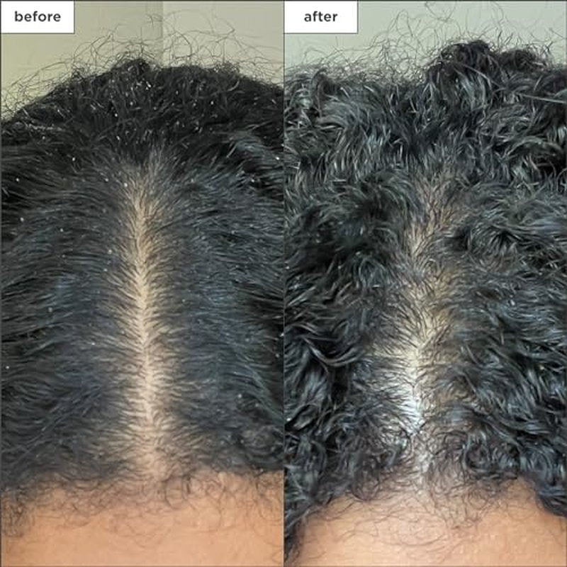 Briogeo Scalp Revival Charcoal + Coconut Oil Micro-Exfoliating Shampoo | Sulfate-Free Scalp Scrub for Dry, Itchy, or Oily Scalp | Detoxifying & Hydrating | Vegan & Cruelty Free