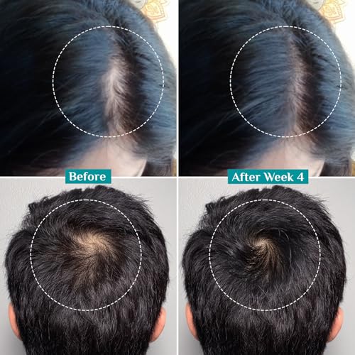 Pilgrim Hair Growth Serum with Redensyl 3%, Anagain 4% & Baicapil 50ml – Pack of 1